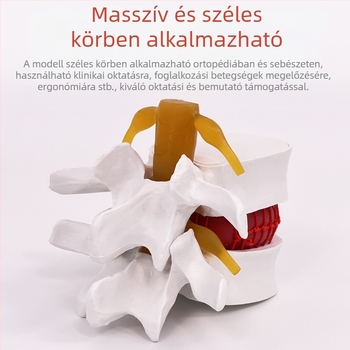 Lumbális gerinc modell orvosi képzéshez – porckorong-kompresszió bemutatása és a gerinccsont patológiája.