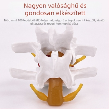 Lumbális gerinc modell orvosi képzéshez – porckorong-kompresszió bemutatása és a gerinccsont patológiája.