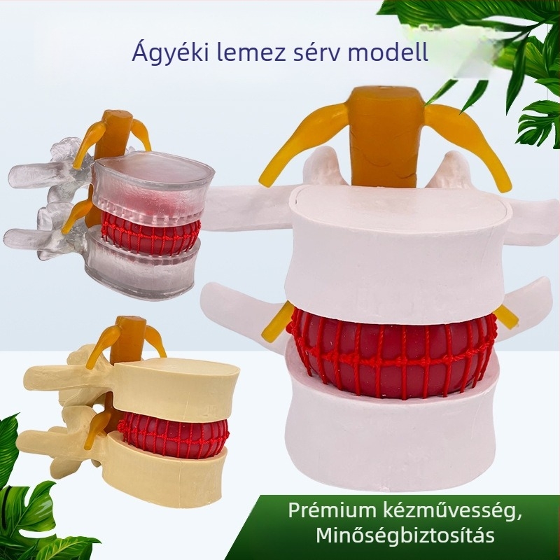 Lumbális gerinc modell orvosi képzéshez – porckorong-kompresszió bemutatása és a gerinccsont patológiája.