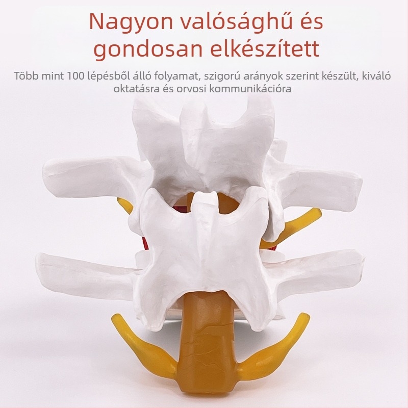 Lumbális gerinc modell orvosi képzéshez – porckorong-kompresszió bemutatása és a gerinccsont patológiája.