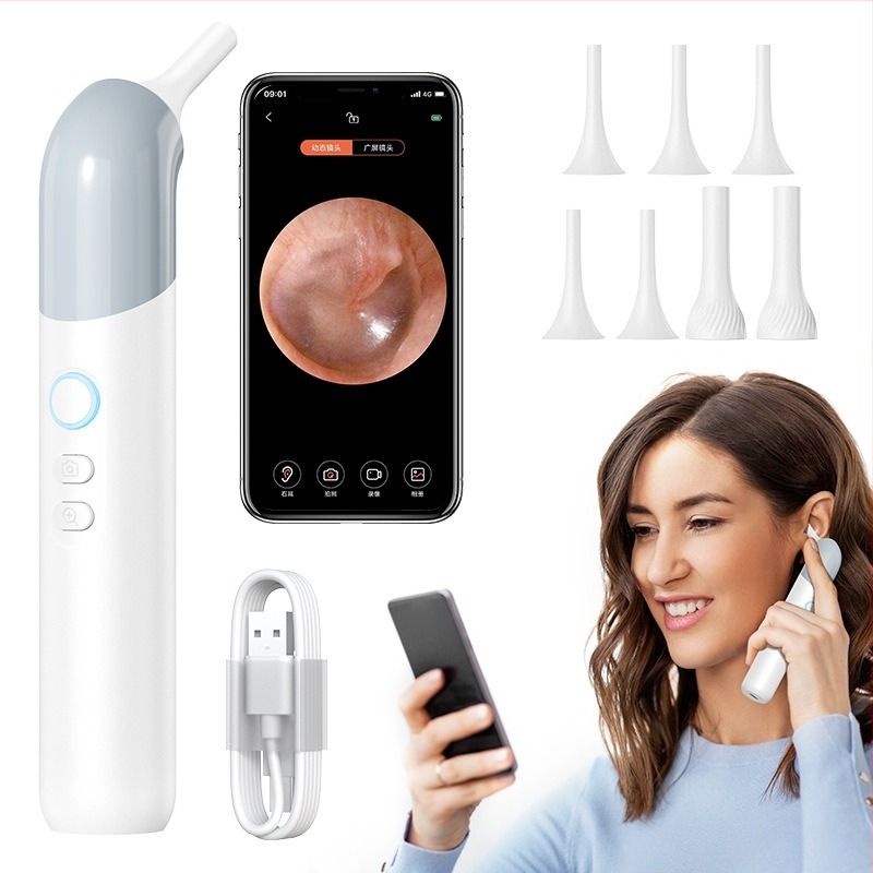 Nagy felbontású intelligens vizuális otoszkóp a fülcsatorna vizsgálatára, Glow fülkanál és fülkanál készlet, anyag ABS+PC, 40 db a dobozban