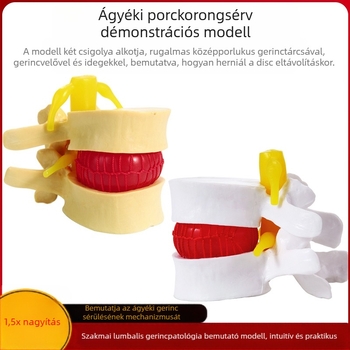 Csigolya közti korong modell, PVC anyagú oktatási anatómiai modell a lumbális patológiák bemutatására, Zhenghe River