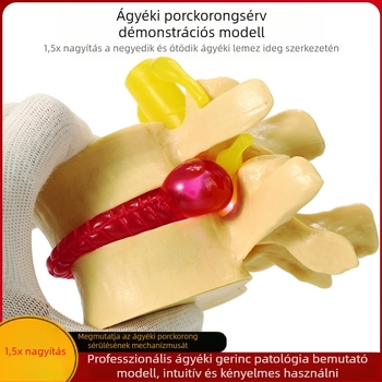 Csigolya közti korong modell, PVC anyagú oktatási anatómiai modell a lumbális patológiák bemutatására, Zhenghe River