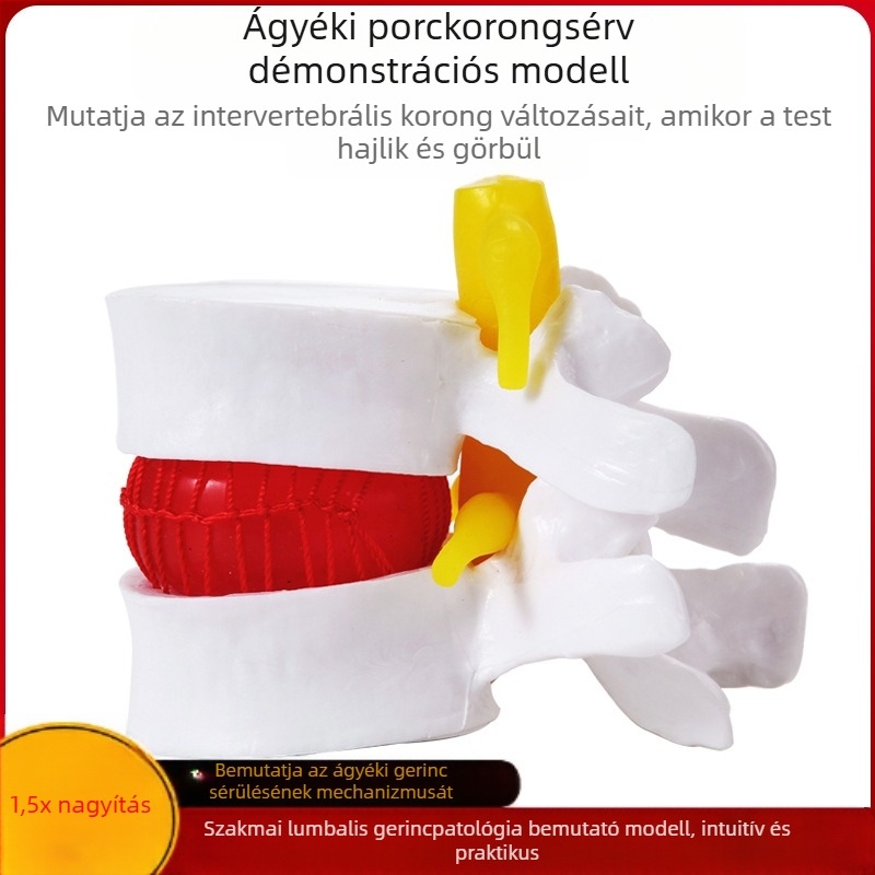 Csigolya közti korong modell, PVC anyagú oktatási anatómiai modell a lumbális patológiák bemutatására, Zhenghe River