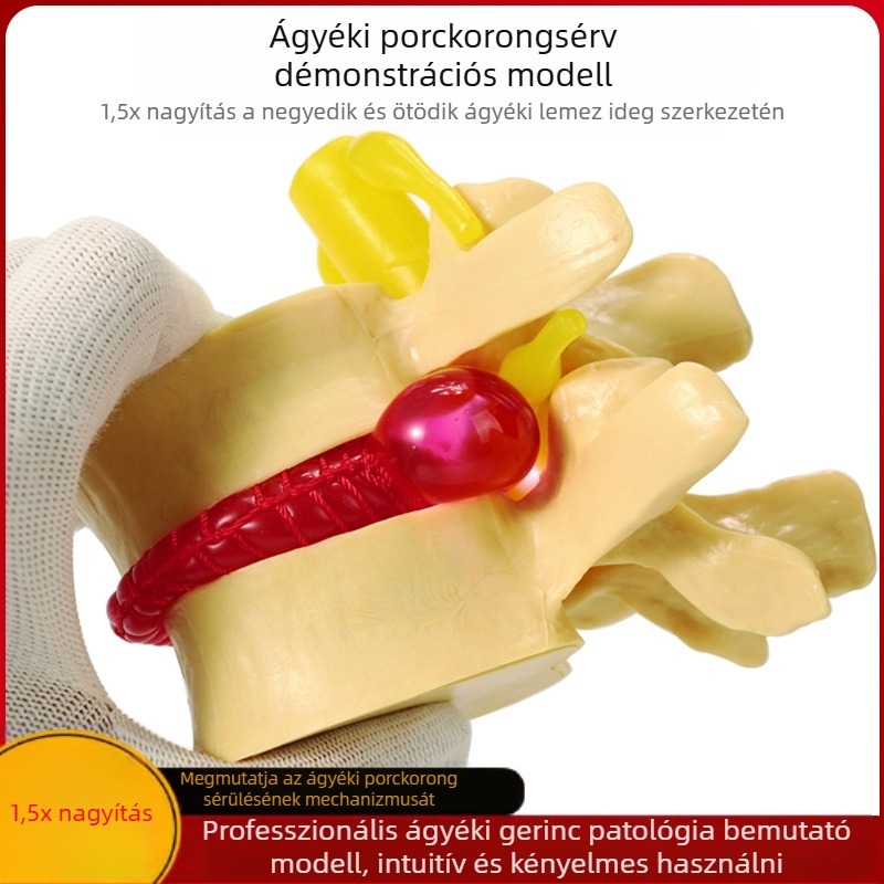 Csigolya közti korong modell, PVC anyagú oktatási anatómiai modell a lumbális patológiák bemutatására, Zhenghe River