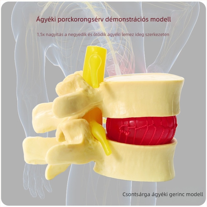 Csigolya közti korong modell, PVC anyagú oktatási anatómiai modell a lumbális patológiák bemutatására, Zhenghe River