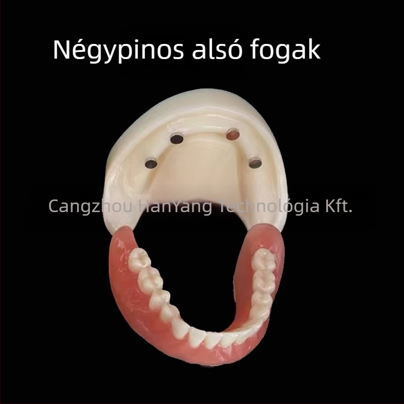 Gyakorló fogimplantátum modell – felső- és alsó állkapocs, fél szájban 2 vagy 4 implantátummal
