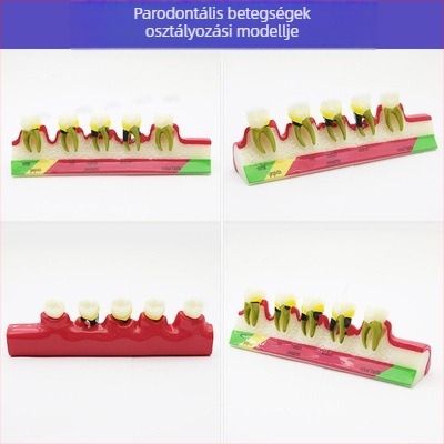 Fogorvosi oktatási modell patológiás rekonstrukcióval és standard implantátummal formával — helyi márka, nyomtatott logóval, fogászati oktatásra