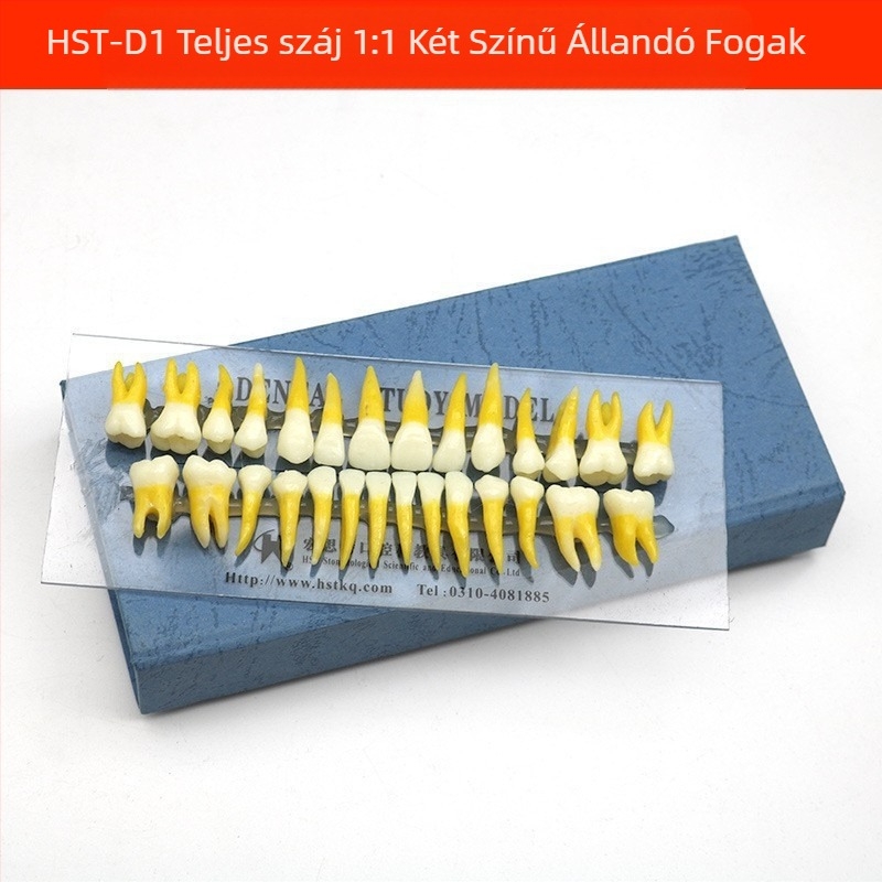 Fogorvosi oktatási modell patológiás rekonstrukcióval és standard implantátummal formával — helyi márka, nyomtatott logóval, fogászati oktatásra