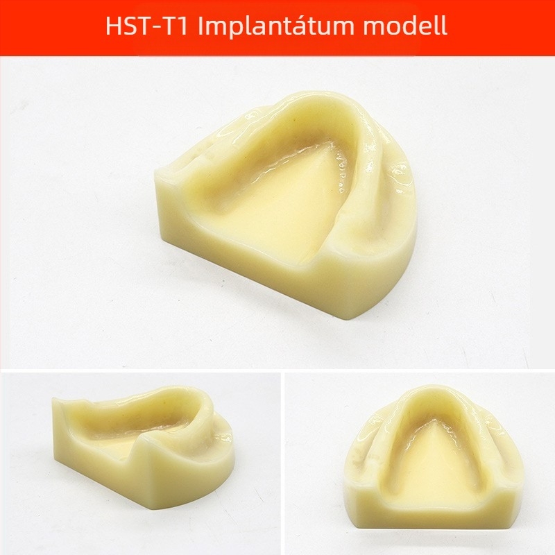 Fogorvosi oktatási modell patológiás rekonstrukcióval és standard implantátummal formával — helyi márka, nyomtatott logóval, fogászati oktatásra
