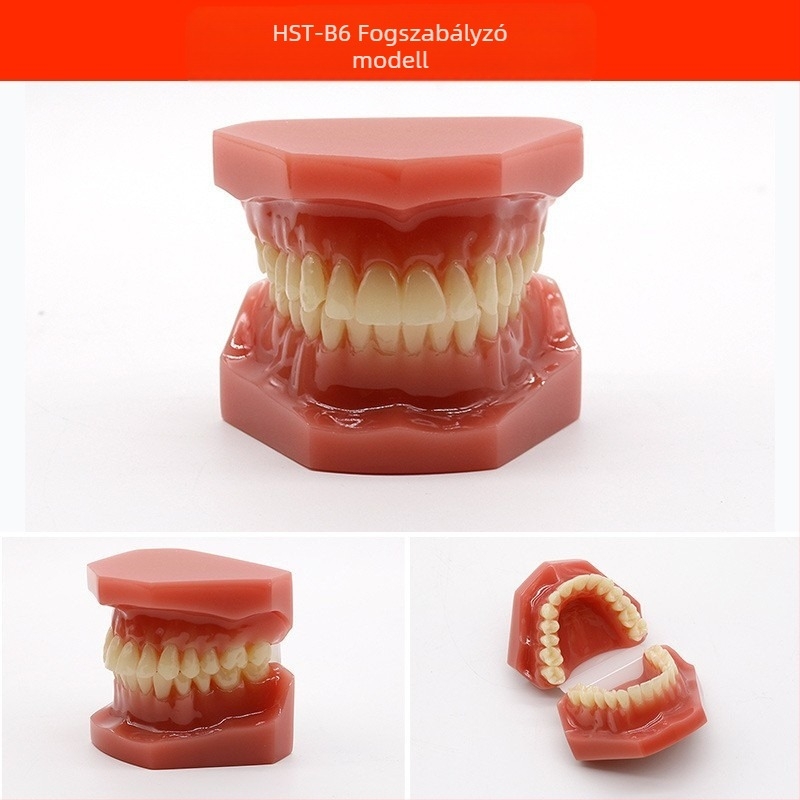 Fogorvosi oktatási modell patológiás rekonstrukcióval és standard implantátummal formával — helyi márka, nyomtatott logóval, fogászati oktatásra