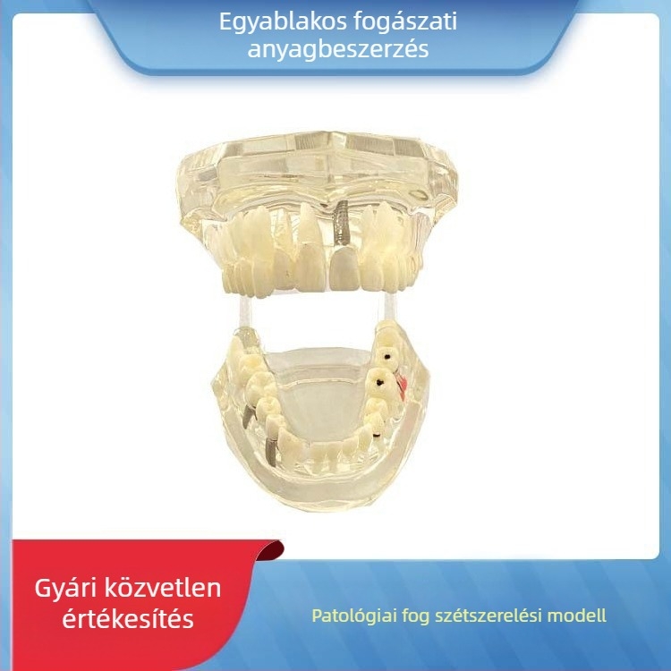 Fogászati oktató fogmodell, levehető fogpótlás, ABS gyanta, felnőtteknek, 180 g