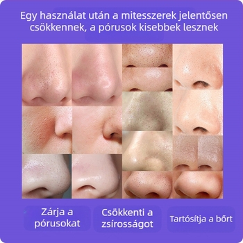 Látványos fekete pöttyök eltávolító készülék — ultrahangos rezgéssel, kézi, modell ZM613, ABS ház, 3 fokozat beállítás