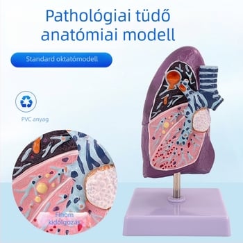 Blue Butterfly műanyag belső szervek modellje: emberi légcső és tüdő – anatómiája, patológiája és dohányos tüdő metszet.