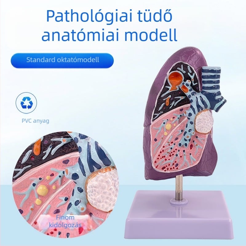 Blue Butterfly műanyag belső szervek modellje: emberi légcső és tüdő – anatómiája, patológiája és dohányos tüdő metszet.