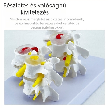 Blue Butterfly PVC négyrészes ágyéki gerinc modell: normál és patológiás csigolyák, discus patológia bemutató