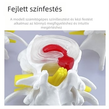 Blue Butterfly PVC négyrészes ágyéki gerinc modell: normál és patológiás csigolyák, discus patológia bemutató