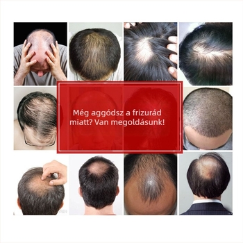 Férfi paróka BF23, valódi emberi haj, rövid haj, mechanizmusos feldolgozás, nem ajánlott forró festés