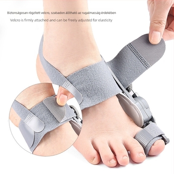 Lábujj-korrigáló – Lábujj-szétválasztó; Anyagok: ABS, nylon, szilikon párna; Modell: Lábujj-korrigáló; Sorozat: Szétválasztó; Stílus: Hallux valgus, személyre szabott dizájn; Visszafordítható korrekció.