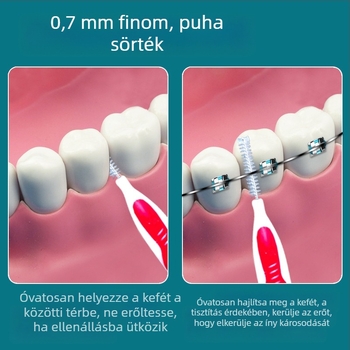 Ortodontikus interdental kefék, 10 darabos készlet, ultrafinom puha sörték, rozsdamentes acél huzal