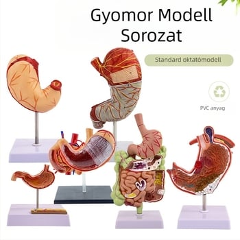 Emberi gyomor anatómiai modell — koronális metszet, patológiás gyomormodell perforációval, gasztroenterológiai képzés