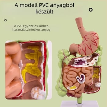 Emberi gyomor anatómiai modell — koronális metszet, patológiás gyomormodell perforációval, gasztroenterológiai képzés