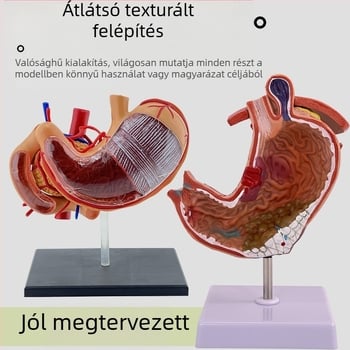 Emberi gyomor anatómiai modell — koronális metszet, patológiás gyomormodell perforációval, gasztroenterológiai képzés