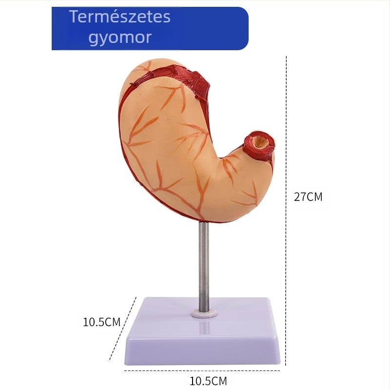 Emberi gyomor anatómiai modell — koronális metszet, patológiás gyomormodell perforációval, gasztroenterológiai képzés