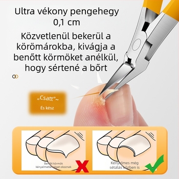 Mingxiang köröm növesedő klipő – műanyag + rozsdamentes acél, hordozható otthoni használatra, körömárok fogó és multifunkcionális csipesz