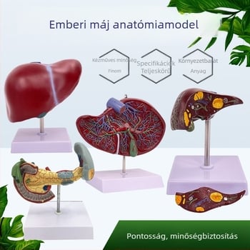 Nagyon realisztikus máj anatómiai modell, hepatobiliáris-pankreatikus-lép-duodenum rendszerrel és domborodó elváltozásokkal