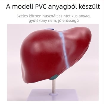 Nagyon realisztikus máj anatómiai modell, hepatobiliáris-pankreatikus-lép-duodenum rendszerrel és domborodó elváltozásokkal
