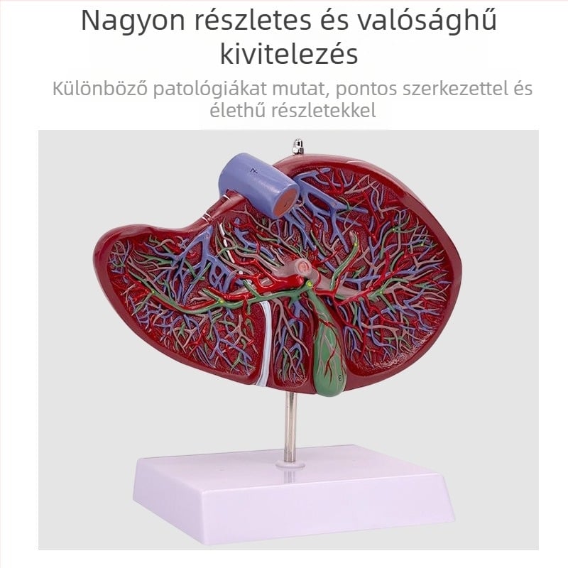 Nagyon realisztikus máj anatómiai modell, hepatobiliáris-pankreatikus-lép-duodenum rendszerrel és domborodó elváltozásokkal