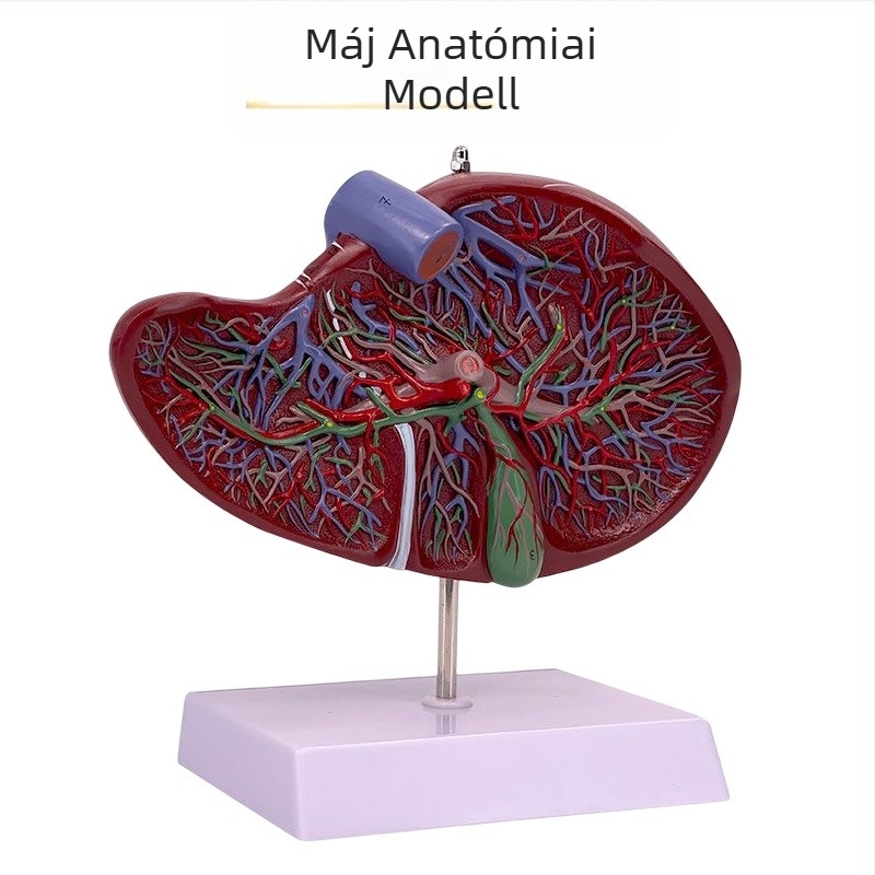 Nagyon realisztikus máj anatómiai modell, hepatobiliáris-pankreatikus-lép-duodenum rendszerrel és domborodó elváltozásokkal