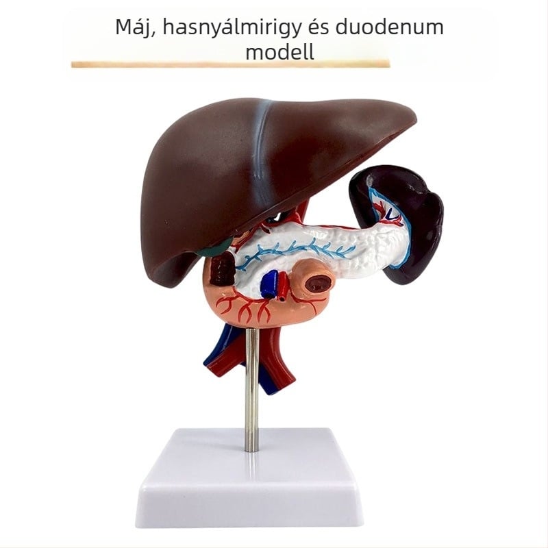 Nagyon realisztikus máj anatómiai modell, hepatobiliáris-pankreatikus-lép-duodenum rendszerrel és domborodó elváltozásokkal