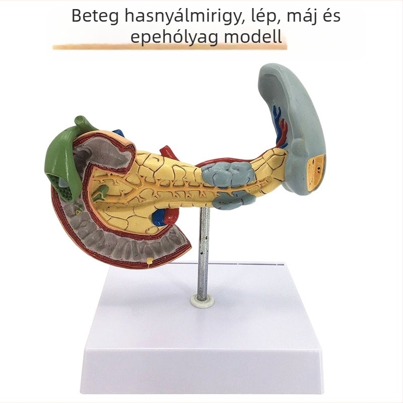 Nagyon realisztikus máj anatómiai modell, hepatobiliáris-pankreatikus-lép-duodenum rendszerrel és domborodó elváltozásokkal
