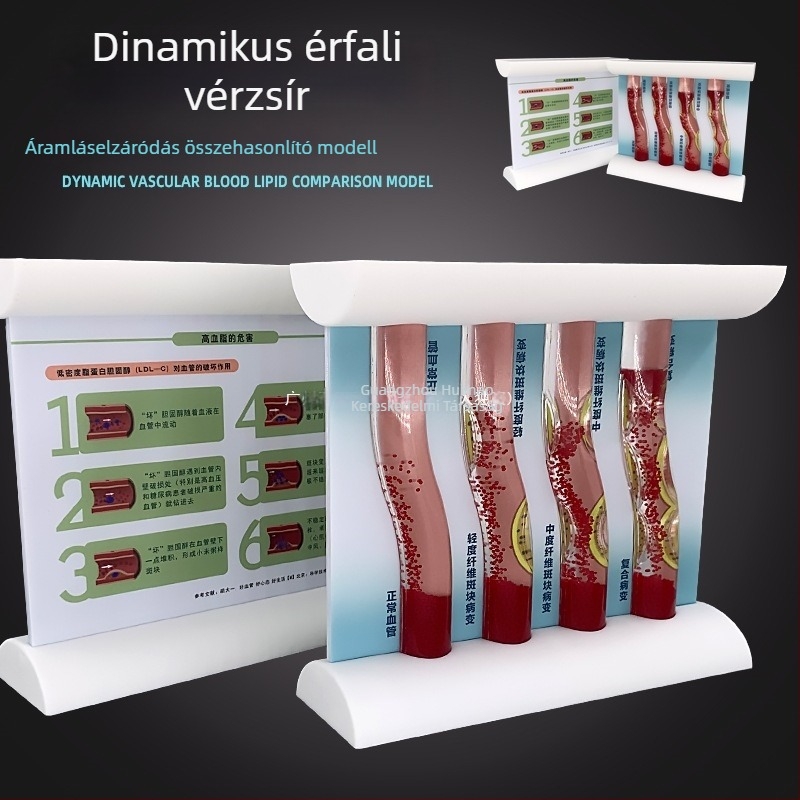 Dinamikus érrendszeri modell műanyagból – magas sűrűségű elzáródás és plakk trombusz – oktató modell