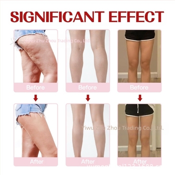 Yumebeauty combfelhúzó testformáló ragasztószalag – orvosi, hipoallergén ragasztó, 10 db/set