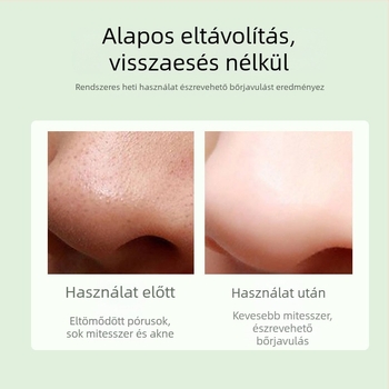 Látható arcápoló készülék mitesszerek eltávolítására, HD kijelzővel és vákuumos mélytisztítással a pórusok számára