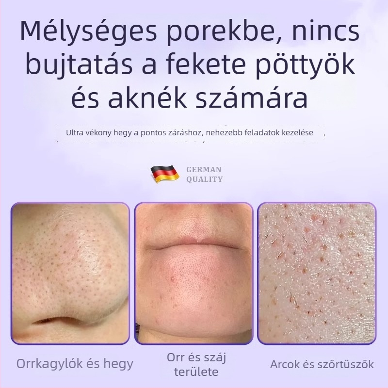 Professzionális kozmetikai eszköz rozsdamentes acélból: sejtes klipsz akné tűvel, delfin alakú csipesszel, származás Yangjiang, 5 éves élettartam