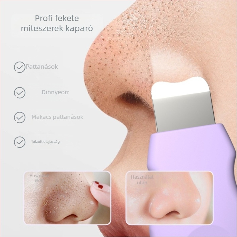 Mini pattanáseltávolító spatula és szilikon arcápoló kefével – modell J501, fizikai adszorpció, kézi működés, szilikon + rozsdamentes acél felépítés, súly 35 g