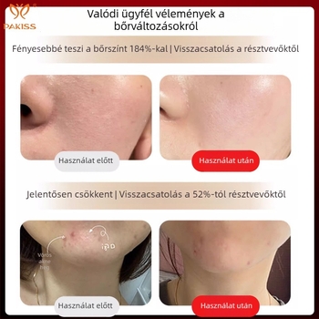 Bőrápoló készülék LED fototerápiával, hordozható, IPX5 vízálló, külső tápegység, otthoni használatra