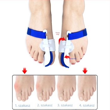Orvosi ortézis nagyujjhoz hallux valgus korrekcióhoz, ujj-leválasztó, modell ZBHL24; anyagok EVA, nylon, mágikus pánt, PU bőr, PP; márka High foot family