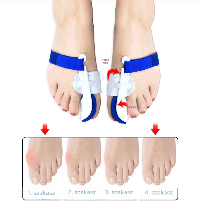 Orvosi ortézis nagyujjhoz hallux valgus korrekcióhoz, ujj-leválasztó, modell ZBHL24; anyagok EVA, nylon, mágikus pánt, PU bőr, PP; márka High foot family