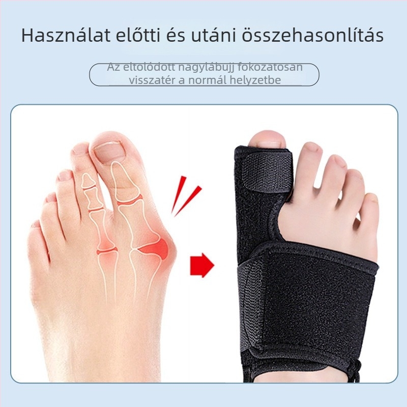 Hallux valgus ortézis, állítható ujjfixáló pánttal, nappal és éjjel