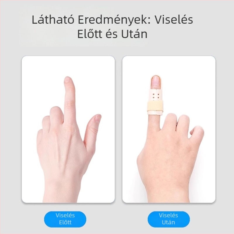 Műanyag ujj-sín a hajlítás korrigálására és az ízület kiegyenesítésére