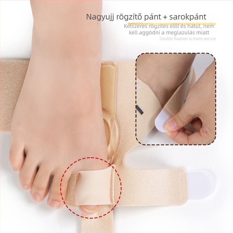 Hallux valgus lábujj fixáló öv, átfedő lábujj szétválasztó, modell Jz170, OK anyag.