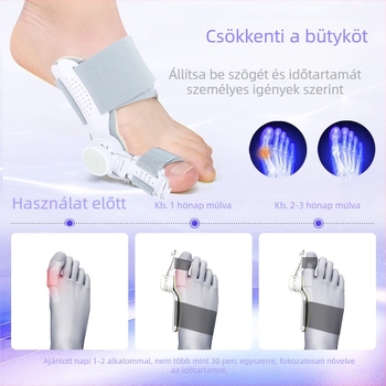 Nagyujj közti elkülönítő és korrektor – nappali/éjszakai mód, gombos stílus, Nylon + SBES keret