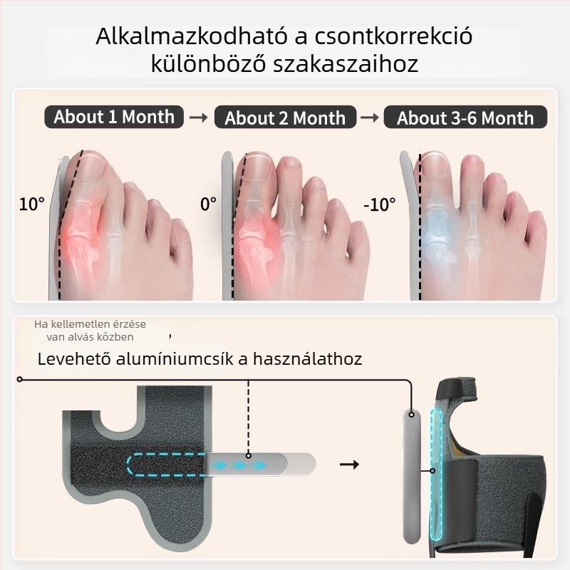 Hallux valgus korrekciós ortózis lábujj elkülönítővel és alumínium sávos támasztással | Modell 24-M-002 | Légáteresztő anyag + Velcro