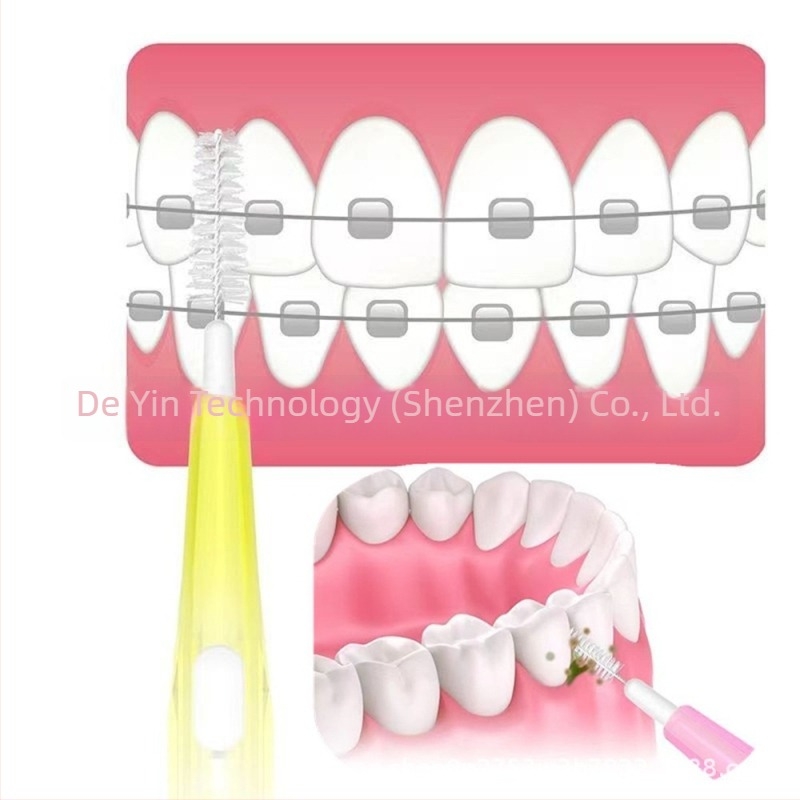 Egyenes toló-nyomó interdental ecset fogszabályozó készülékekhez, 30 db/csomag, modell 52012