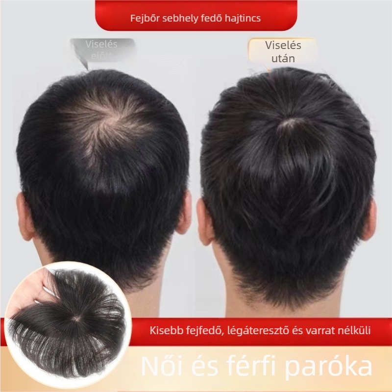 Fejtetői paróka - valódi emberi haj, egyenes haj, sima fedés heg és hajhullás ellen (nem festhető vagy vasalható)